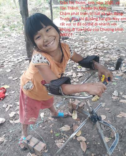 Hình 1 Em khuyết tật tại Bình Phước nhận dụng cụ trợ giúp từ dự án DIRECTUSAID